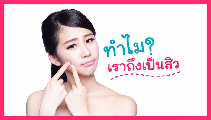 ทำไมเราถึงเป็นสิว!