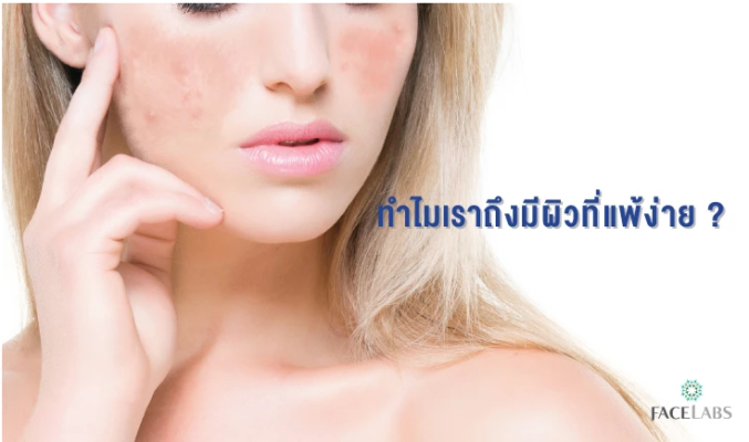 ผิวแพ้ง่าย..ปัญหาใหญ่ที่ไม่ควรมองข้าม