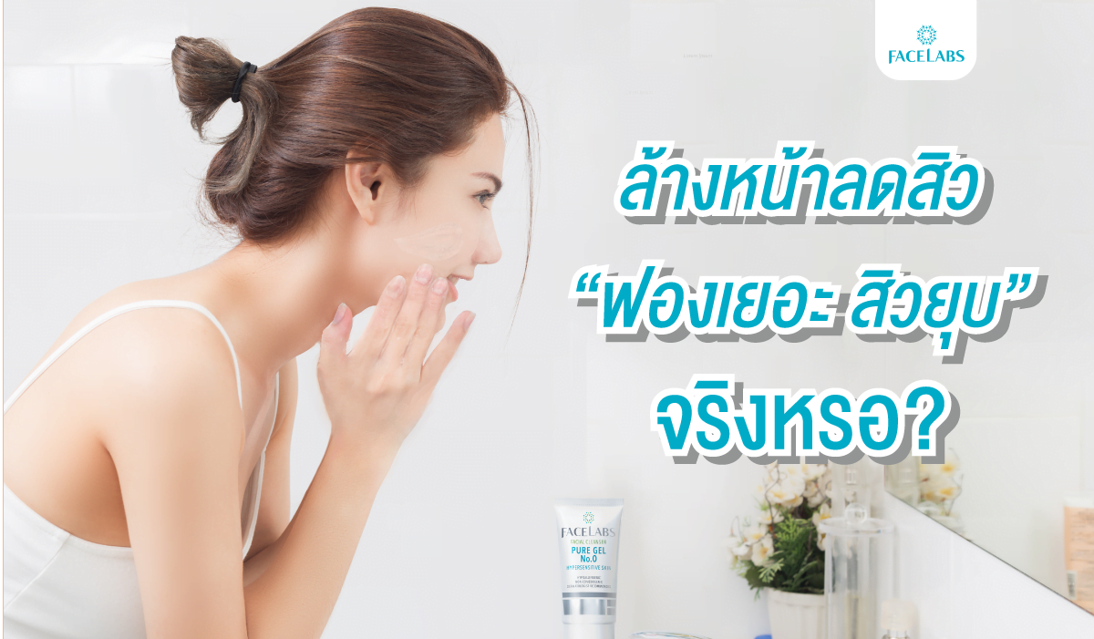 ล้างหน้าลดสิว“ฟองเยอะ สิวยุบ” จริงหรอ