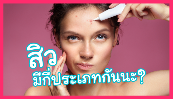 สิวมีกี่ประเภท