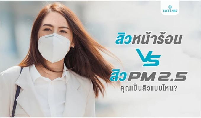 สิวที่ขึ้นเป็นสิวหน้าร้อน หรือ สิว PM 2.5?