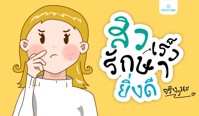 รักษาสิว