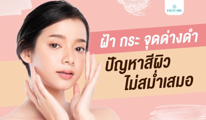 ฝ้า กระ จุดด่างดำ ปัญหาสีผิวไม่สม่ำเสมอ