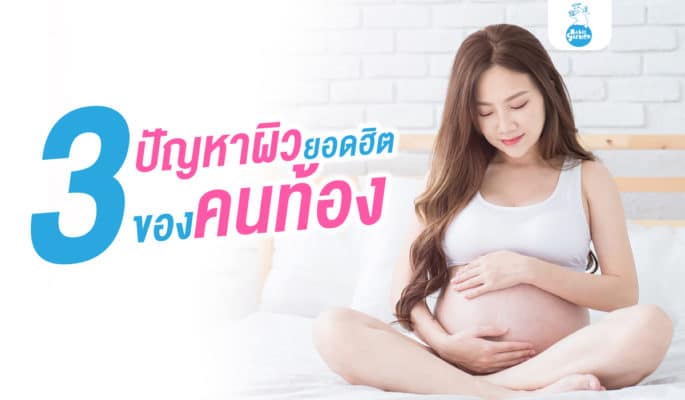 ปัญหาผิวยอดฮิตของคนท้อง