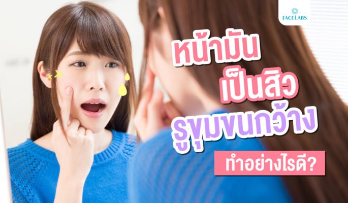 [:th]หน้ามัน เป็นสิว รูขุมขนกว้าง ทำไงดี[:]