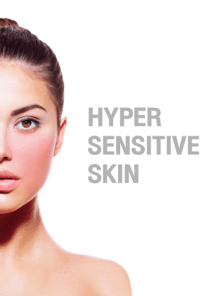 hypersensitiveskin-ผิวแพ้ง่าย