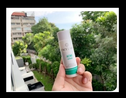 [:th]Acne-Lotion-Meaowpaiiya[:]